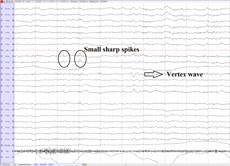 File:SSS right temporal in sleep stadium non REM 1 (average).png